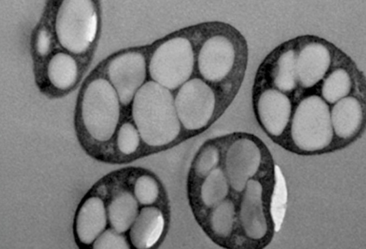 Investigadores chilenos modelaron una bacteria para producir bioplásticos